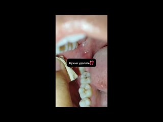 video by overheard belozersk